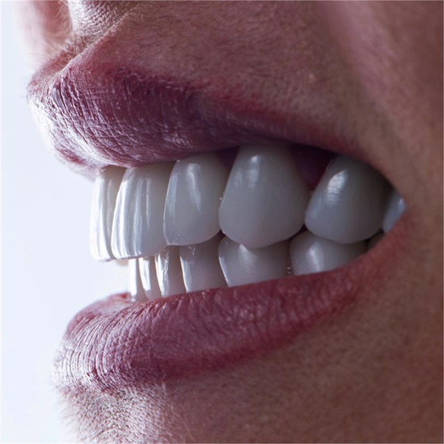 Las mejores soluciones de estética dental en A Coruña